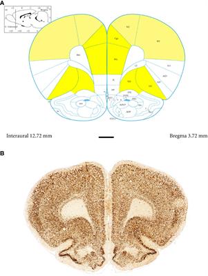 Parvalbumin interneuron deficiency in the prefrontal and motor cortices of spontaneously hypertensive rats: an attention-deficit hyperactivity disorder animal model insight